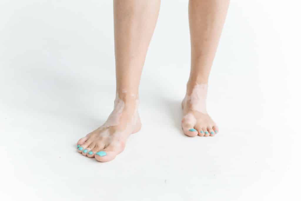 Kako omekšati nokte na nogama